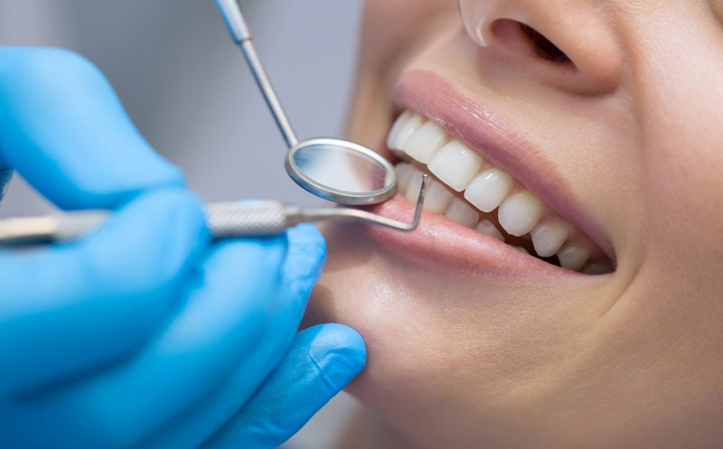 چرا تعرفه دندانپزشکی متغیر است؟ بررسی عوامل تأثیرگذار بر قیمت‌ها