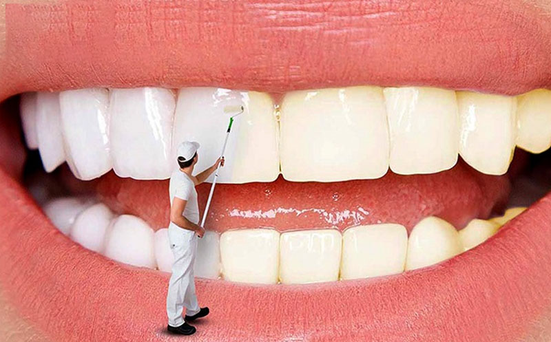 چرا تعرفه دندانپزشکی متغیر است؟ بررسی عوامل تأثیرگذار بر قیمت‌ها